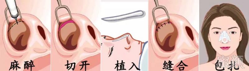 https://img.miyanlife.com/timg/160626/2046455c2-6.jpg