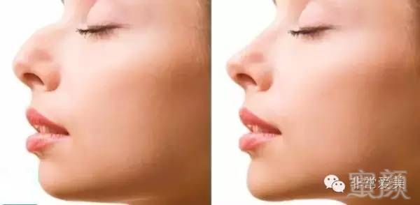https://img.miyanlife.com/timg/160626/2046461118-8.jpg