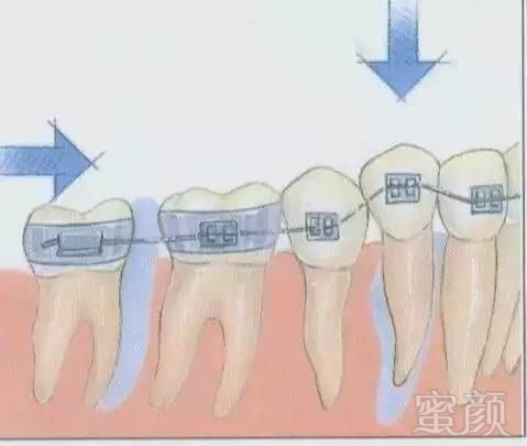 案例图片