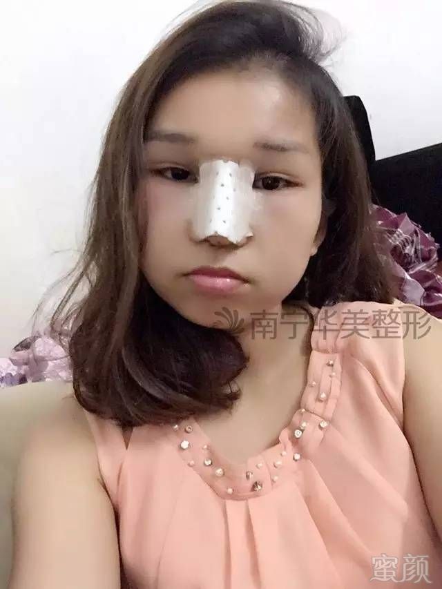 https://img.miyanlife.com/timg/160702/09394H252-0.jpg