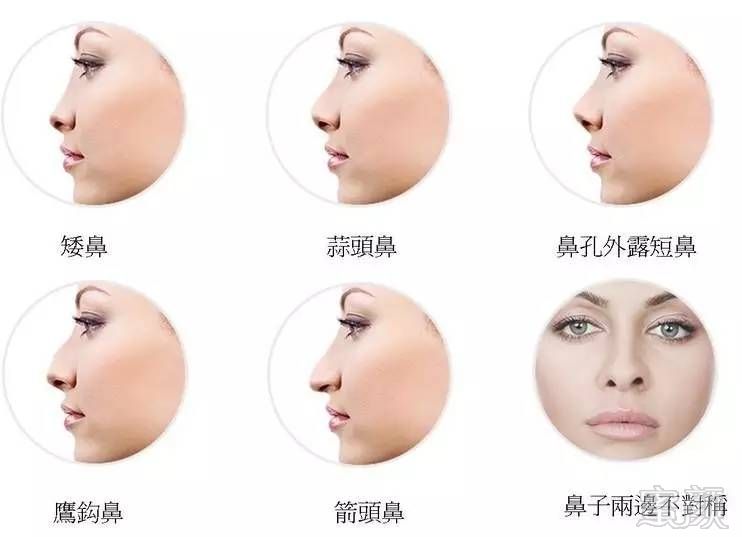 https://img.miyanlife.com/timg/160703/2350005037-3.jpg