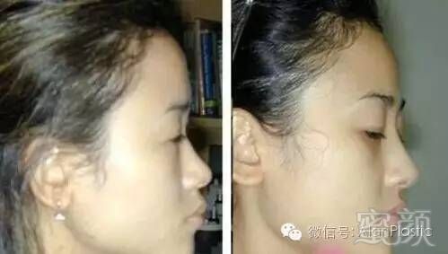 https://img.miyanlife.com/timg/160705/142P92M2-1.jpg