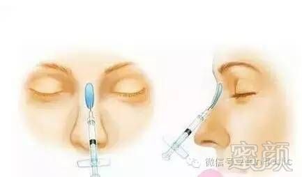 https://img.miyanlife.com/timg/160705/142Q03G0-2.jpg