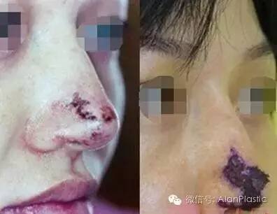 https://img.miyanlife.com/timg/160705/142Q0L01-3.jpg