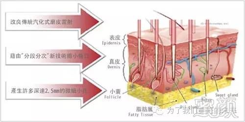 https://img.miyanlife.com/timg/160708/12010M646-2.jpg