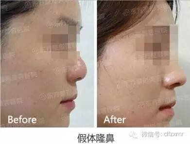 https://img.miyanlife.com/timg/160709/211H31258-12.jpg