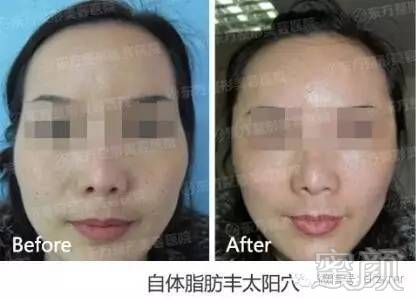 https://img.miyanlife.com/timg/160709/211H3C42-11.jpg