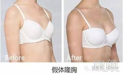 https://img.miyanlife.com/timg/160709/211H43492-13.jpg