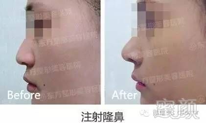 https://img.miyanlife.com/timg/160709/211H46118-15.jpg