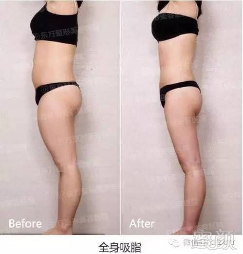 https://img.miyanlife.com/timg/160709/211H46120-14.jpg
