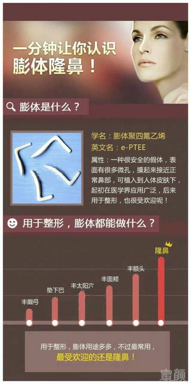 https://img.miyanlife.com/timg/160710/19431239B-0.jpg