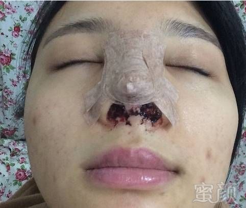 https://img.miyanlife.com/timg/160711/1HQ34639-2.jpg