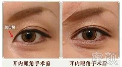 https://img.miyanlife.com/timg/160711/2214351B4-13.jpg