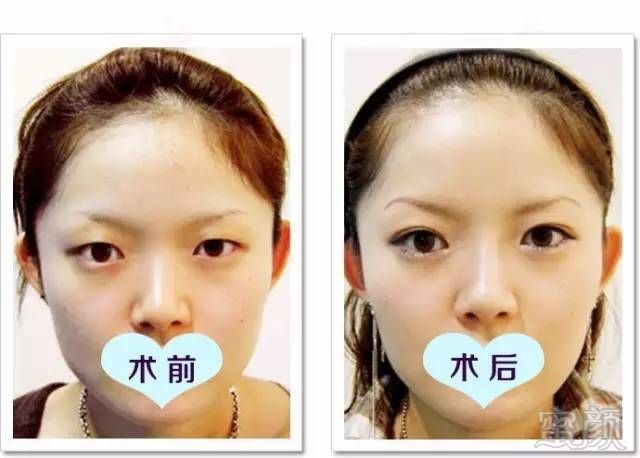 https://img.miyanlife.com/timg/160711/2214354606-12.jpg