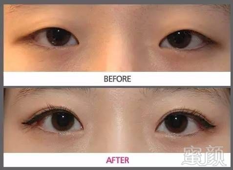 https://img.miyanlife.com/timg/160711/22143554Y-11.jpg