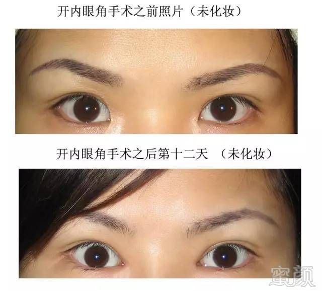 https://img.miyanlife.com/timg/160711/22143C555-14.jpg