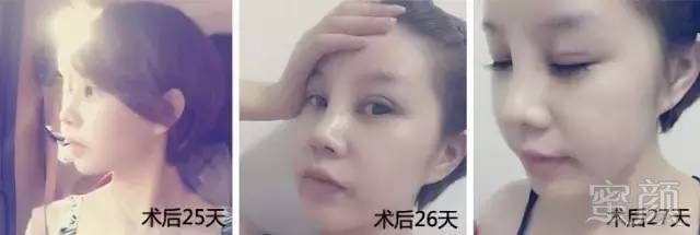 https://img.miyanlife.com/timg/160715/1JI414P-4.jpg