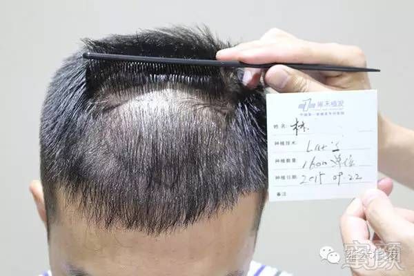 https://img.miyanlife.com/timg/160718/095019C12-1.jpg