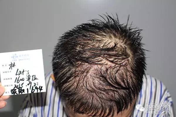https://img.miyanlife.com/timg/160718/0950211022-6.jpg