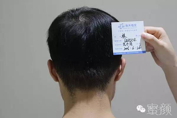 https://img.miyanlife.com/timg/160718/0950252153-15.jpg
