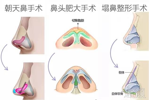 案例图片