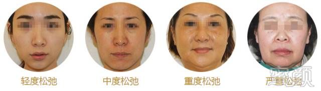 https://img.miyanlife.com/timg/160728/2154202S8-1.jpg