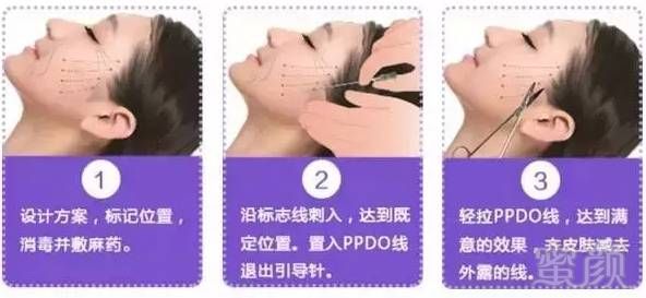 https://img.miyanlife.com/timg/160728/215422B20-6.jpg