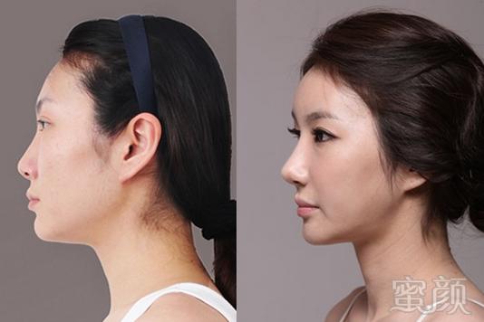 https://img.miyanlife.com/timg/160803/1J0422F9-1-j.jpg