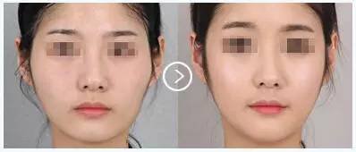 https://img.miyanlife.com/timg/160803/1J0442509-6.jpg