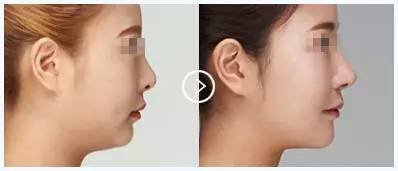 https://img.miyanlife.com/timg/160803/1J0446053-7.jpg