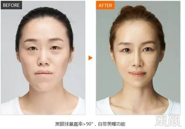 https://img.miyanlife.com/timg/160804/2320212402-8.jpg