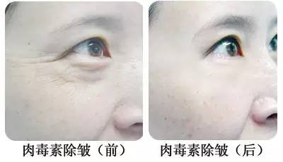 https://img.miyanlife.com/timg/160805/0951533960-8.jpg