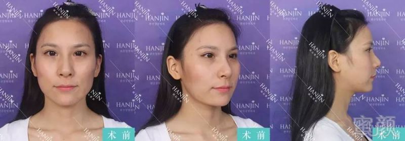 https://img.miyanlife.com/timg/160806/203040C92-1.jpg