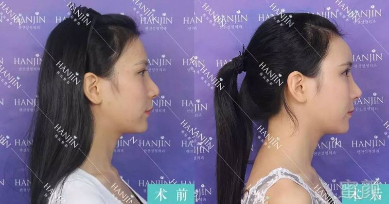 https://img.miyanlife.com/timg/160806/2030422393-5.jpg