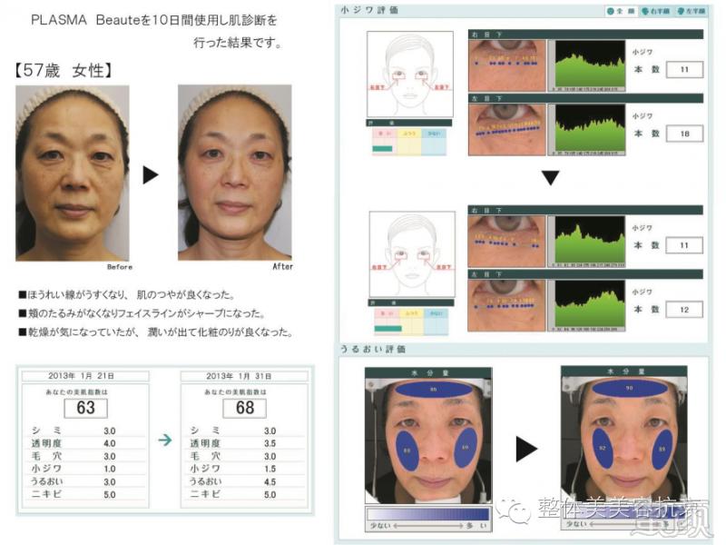 https://img.miyanlife.com/timg/160807/10540531K-20-j.jpg