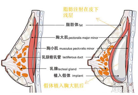 https://img.miyanlife.com/timg/160807/2154102604-3-j.jpg