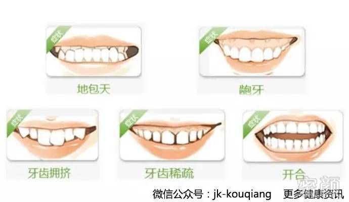 https://img.miyanlife.com/timg/160808/2220301G5-0.jpg