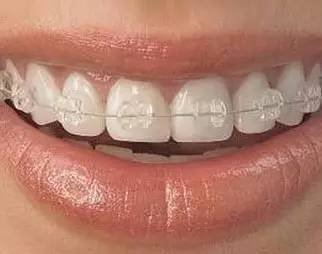 https://img.miyanlife.com/timg/160808/22203220B-9.jpg