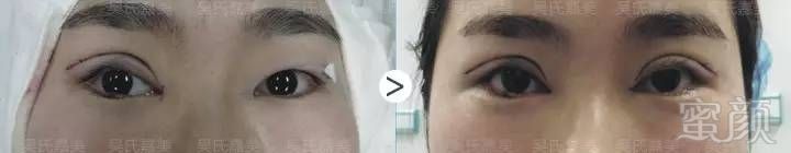 https://img.miyanlife.com/timg/160809/2301553M0-11.jpg