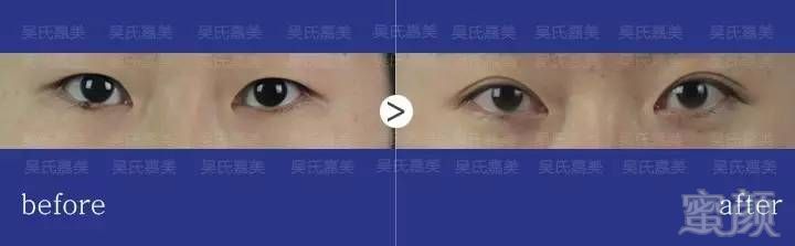 https://img.miyanlife.com/timg/160809/23015A2F-12.jpg