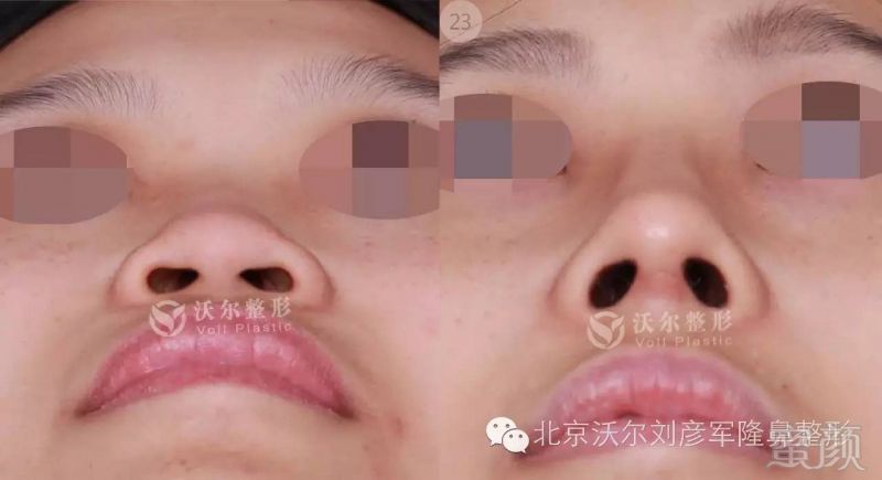 https://img.miyanlife.com/timg/160811/145G44647-4.jpg
