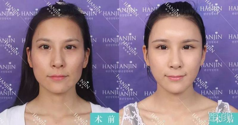 https://img.miyanlife.com/timg/160815/151351KR-3.jpg