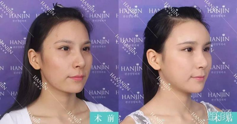 https://img.miyanlife.com/timg/160815/1513522M5-4.jpg