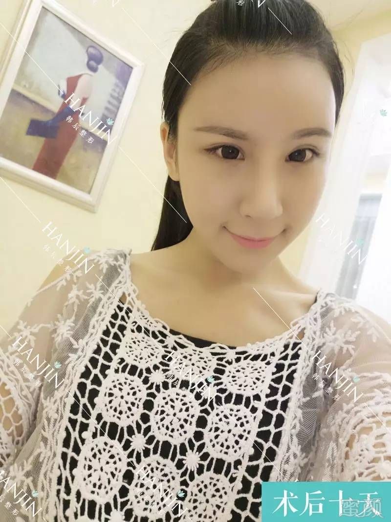 https://img.miyanlife.com/timg/160815/1513534629-7.jpg