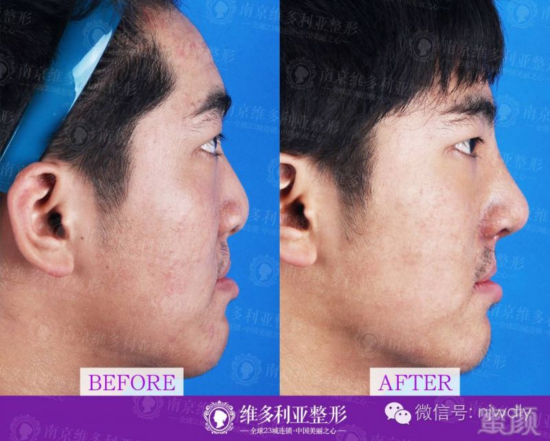 https://img.miyanlife.com/timg/160817/2149301R0-2.jpg