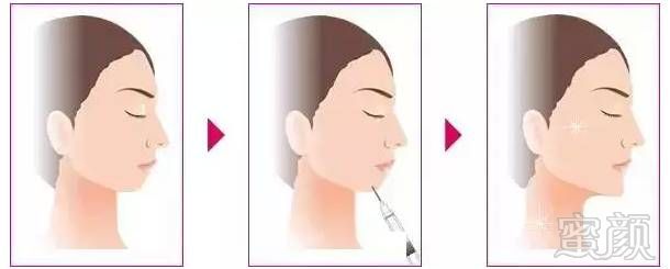 https://img.miyanlife.com/timg/160818/1I9441X1-7.jpg
