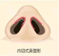https://img.miyanlife.com/timg/160818/20444133Q-3.jpg