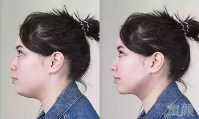 https://img.miyanlife.com/timg/160820/135I32b4-11.jpg