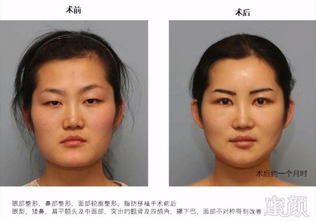 https://img.miyanlife.com/timg/160820/22232WE1-5.jpg