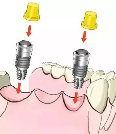 https://img.miyanlife.com/timg/160822/1J3392N3-5.jpg